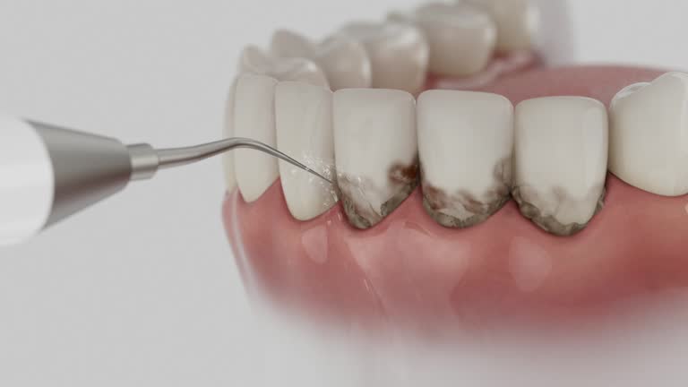 Reliable Root Canal Treatment contractor in Hancock County County, KY by Dentist Open Now